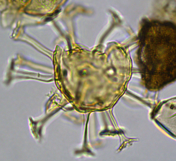 Hystrichosphaeridium tubiferum Htub27X23334385965b.jpg